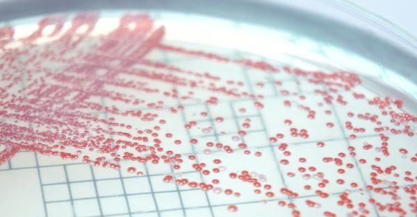 Step by Step Guide to Remove Mold from humidifier